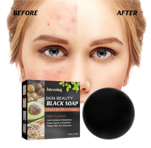 Savon Solide Nettoyant Visage Fait Main de Haute Qualité 120g, Bestseller, Anti-Acné, Contrôle du Sébum, Blanchissant, pour le Bain et le Corps - Product Image 4