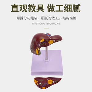 Modèle de pathologie hépatique, modèle de foie gras, modèle hépatobiliaire, foie malade, modèle d'anatomie hépatique humaine simulée - Product Image 3