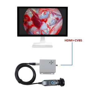 <span class=keywords><strong>TUYOU</strong></span> Medical Full HD 1080P Cámara de endoscopio portátil médico para otoscopio de oído nasal ENT Laparoscopio - Product Image 2