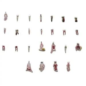 Dientes humanos: juego 2 veces ampliado de caja de 25 dientes en material resistente a roturas que tiene detalles anatómicos precisos - Product Image 1