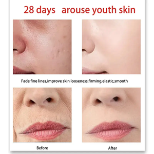 Toptan fiyat 2025 Ginseng altın yaşlanma özü hafif kırışıklık nemlendirici, parlatıcı 30ml hafifletmek - Product Image 3