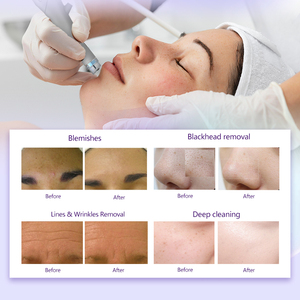 Hydramaster chất lượng hàng đầu Hydra oxy máy bay phản lực dermabrasion Hydro Aqua lột vẻ đẹp khuôn mặt thiết bị Salon máy trên khuôn mặt - Product Image 4