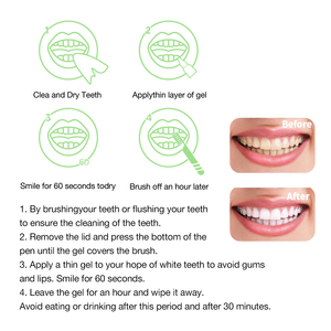 Gel blanchissant naturel pour les dents 2 ml pour lampe LED, stylo de blanchiment dentaire professionnel OEM - Product Image 6