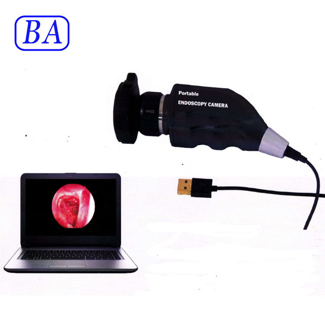 Medical ENT Mini hd Camera Set Usb Smallest Camera