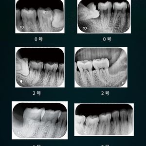 Vrn Eq-600 Dental X-ray Imaging Panel System Class Ii Electric White Rectangular - Product Image 5