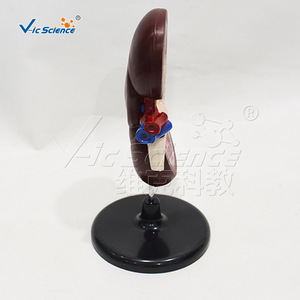 Modèle d'anatomie rénale, modèle de structure rénale humaine, aide pédagogique pour la démonstration en urologie - Product Image 2