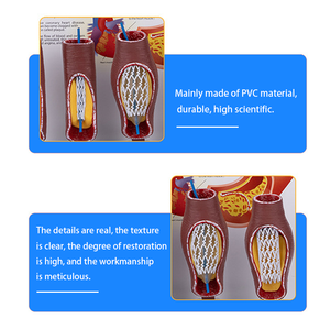 Modelo <span class=keywords><strong>de</strong></span> stent vascular <span class=keywords><strong>de</strong></span> ciencia médica modelo vascular humano enseñanza médica modelo <span class=keywords><strong>de</strong></span> <span class=keywords><strong>anatomía</strong></span> vascular <span class=keywords><strong>patológica</strong></span> - Product Image 2