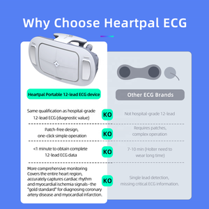 เครื่องตรวจคลื่นไฟฟ้าหัวใจ AI อัจฉริยะ ราคาโรงงาน ขายดี - เครื่อง <span class=keywords><strong>EKG</strong></span> แบบพกพา 12 ช่องสัญญาณ พร้อมการวิเคราะห์ขั้นสูง สำหรับการจำหน่ายทั่วโลก - Product Image 3