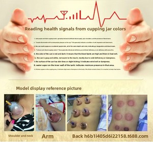 Set Professionale per Terapia con Coppettazione Baibaikang 32 Pezzi, Controllo Manuale, Coppe Hijama in ABS per Rilassamento Muscolare Totale - Product Image 4