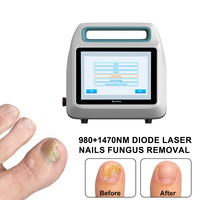 Endo Fiber Lift 980 Y 1470 Traitement de l'onychomycose et des mycoses des ongles et des pieds Autres produits de beauté et de soins personnels