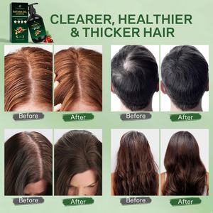 Produit de soin des cheveux naturel et biologique personnalisé en usine avec logo privé, shampooing à l'huile de Batana - Product Image 6