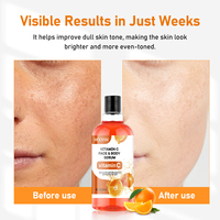 Sérum à la vitamine VC en marque privée OEM 500 ml pour le visage et le corps, améliore la peau terne, rafraîchissant, hydratant et nourrissant