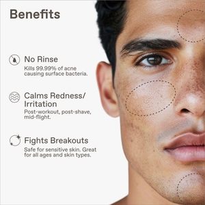 สเปรย์กรดไฮโปคลอไรซ์ ช่วยรักษาสิว ผื่นคัน และผื่นแพ้ ผสมกรดซาลิไซลิก 2% และน้ำมันทีทรี สเปรย์กำจัดสิว - Product Image 6