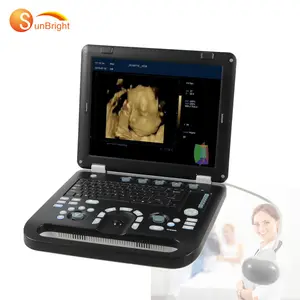 Máquina de ultrassom Doppler 3D 4D para laptop, equipamento médico hospitalar mais vendido e barato