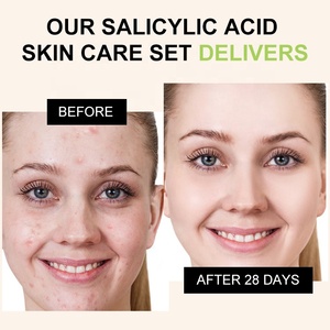 Hàn Quốc Phụ nữ hàng ngày chăm sóc da <span class=keywords><strong>Kit</strong></span> 4-mảnh thiết lập giữ ẩm dầu-kiểm Soát Ph cân bằng hàng ngày mặt salicylic axit chăm sóc da Bộ - Product Image 4