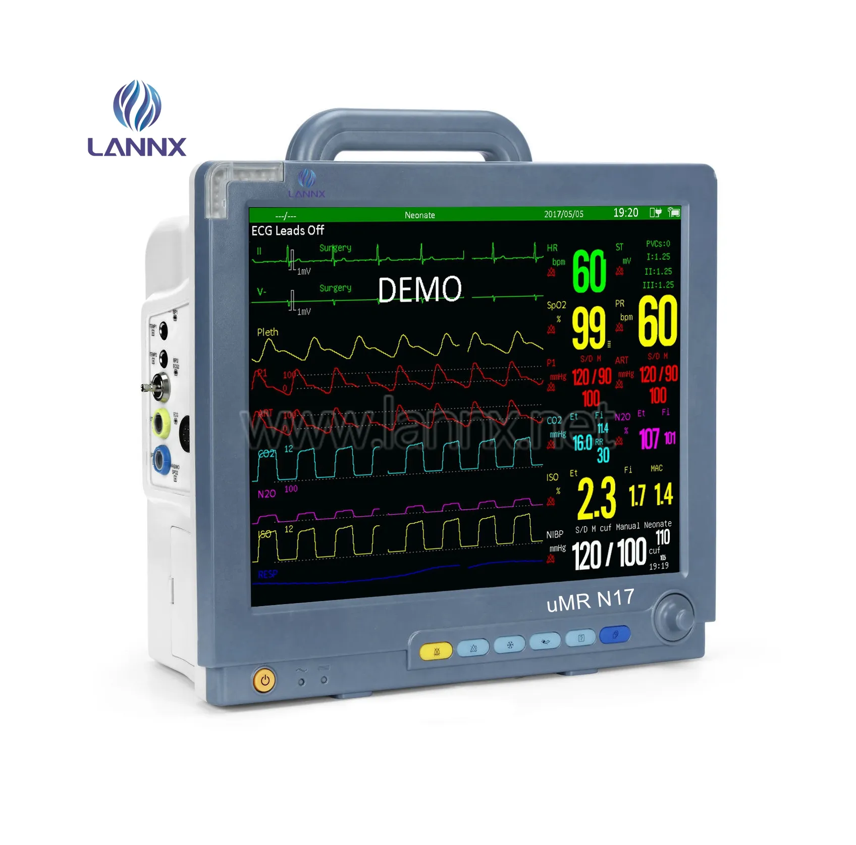 LANNX uMR N17 Competitive Price hospital ambulance instrument Multiparameter Patient Monitor medical portable vital sign monitor