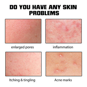 Suero para el Cuidado de la Piel 100% Natural de Marca Privada al por Mayor, Control de Grasa, Aclara las Marcas del Acné, Repara la Barrera Cutánea - Product Image 4