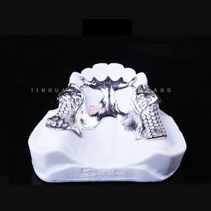 Marco metálico completo <span class=keywords><strong>superior</strong></span> e inferior con <span class=keywords><strong>dentadura</strong></span> <span class=keywords><strong>parcial</strong></span> acrílica - Product Image 4