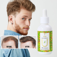 Private Label Bio-Haarserum-Öl mit Squalan für Haarwachstum Alkoholfrei & Sulfatfrei für Männer & Frauen