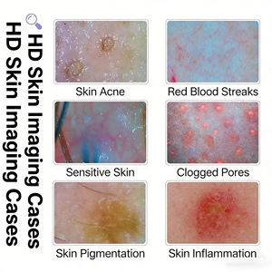 Productos de Belleza, Herramientas para el Cuidado de la Piel, Máquina de Hidrodermoabrasión 7 en 1, Hidrógeno de Escritorio para el Cuidado Facial - Product Image 4