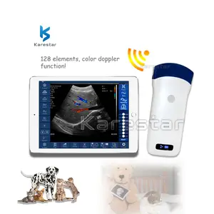 Usb Wifi Ecografo Draagbare Ultrasounido Sonde Medische Hand Gehouden Draadloze Ultrasone Scanners