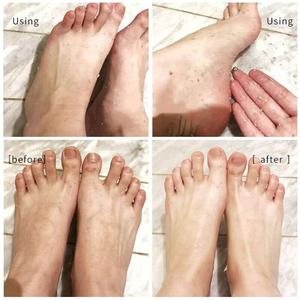 Soins quotidiens pour adoucir la peau dure pour les pieds hydratant anti-transpirant spray exfoliant pour les pieds - Product Image 4