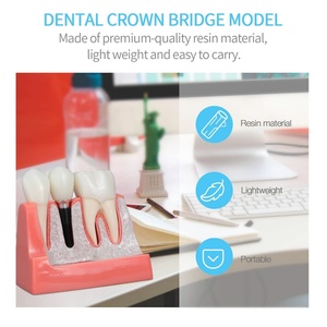 4 Times Medical Science Education Studying Dental Implant Model Removable <b>Teeth</b> Multi-Purpose <b>Teeth</b> <b>Whitening</b> Accessories - Product Image 4