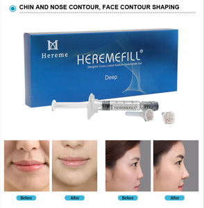 Solution de Remplissage Dermal à l'Acide Hyaluronique 2ml pour un Soutien Volumineux et un Remodelage Facial - Product Image 4