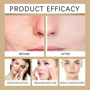 Tonique Nettoyant en Profondeur pour les Pores, Soin Éclaircissant Naturel, Tonique au Riz Réducteur de Pores - Product Image 2