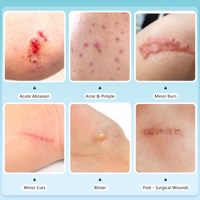 Stérile Étanche Très Absorbant Auto-Adhésif Lit Plaie Bandages Patch Hydrocolloïde Rouleau pour Brûler Blister Acné Pimple Care