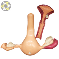 Modèle anatomique pathologique des fibromes utérins féminins en PVC écologique grandeur nature certifié ISO pour l'utilisation en écoles de sciences médicales