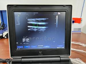 Échographe Doppler Couleur Portable 3D pour Hôpital, Machine à Ultrasons Portable pour Grossesse, Échographe Vétérinaire - Product Image 4
