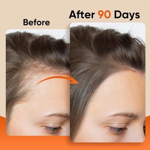 Prévient la perte de cheveux, améliore l'épaisseur, huile de Batana 100% brute pressée à froid, masque capillaire biologique pour hommes et femmes, tous types de cheveux - Product Image 2