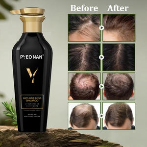 Champú Anticaída Más Popular, Orgánico, Sin Sulfatos, de Origen Natural, con Fórmula Engrosadora y para <span class=keywords><strong>el</strong></span> Crecimiento del <span class=keywords><strong>Cabello</strong></span> - Product Image 4