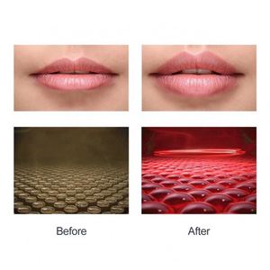 Hot Gift Productos de belleza Masajeador de labios con carga USB Plumper para Girl Lady - Product Image 6
