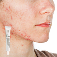Crema Facial de Colágeno Humano Recombinante Tipo III OEM/ODM, Previene Cicatrices de Acné, Hiperpigmentación, Reafirmante, para Piel Sensible