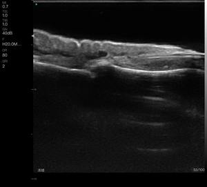 चेहरे के फिलर्स के लिए HF-L4PC 192 तत्व (16-20mhz) - Product Image 4