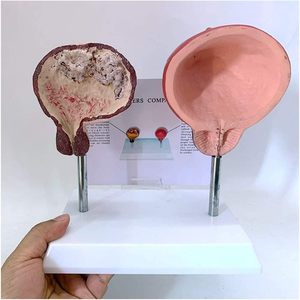 Modèle de vessie humaine Yulin utilisé pour l'étude de la structure des systèmes urinaires et reproducteurs, conforme aux normes CE/ISO pour les études post-universitaires. - Product Image 3