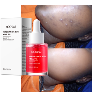 OEM Niacinamida 10% + Txa 4% Suero corrector de manchas oscuras Poro-shrimkimg Antienvejecimiento y brillo 30ml Suero facial MOOYAM - Product Image 1
