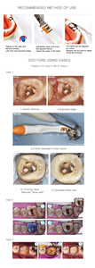 <span class=keywords><strong>Prix</strong></span> d'usine utiliser facilement l'équipement de prothèse dentaire bande matricielle pré-profilée pour la restauration des dents - Product Image 6