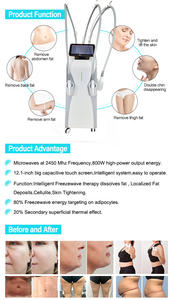 Máquina de Adelgazamiento con Tecnología Láser RF Ice Wave, Reduce la Celulitis, Reafirma la <span class=keywords><strong>Piel</strong></span>, Quema Grasa Abdominal - Product Image 6