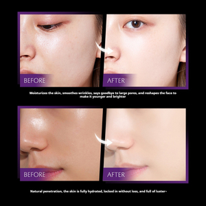 Productos Coreanos para el Cuidado de la Piel de Mujer, Precio de Fábrica, Marca Privada, Crema y Loción Facial Hidratante Antiarrugas para el Cuidado Facial - Product Image 6
