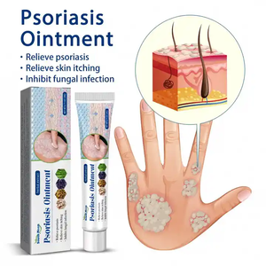 Crema para aliviar la picazón, prurito, psoriasis, recién llegado, crema para enfermedades de la piel a base de hierbas, ungüento, cuidado de la salud para la psoriasis - Product Image 5