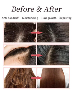 Bộ chăm sóc tóc Rosemary Maiqeix New Trend dành cho nam giới, gồm dầu gội và dầu xả dưỡng ẩm, trị gàu, chăm sóc tóc khỏe mạnh, sản xuất theo đơn đặt hàng (OEM). - Product Image 6