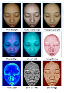 Skin Scalp Testing <b>Machine</b> 3D Simulation Moisture Detection Beauty Salon Equipment Aging Detection - Product Image 6