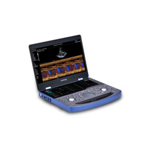 Système d'imagerie médicale à ultrasons de diagnostic vétérinaire Mindray Vetus E7 porté à la main pour équipement vétérinaire - Product Image 2