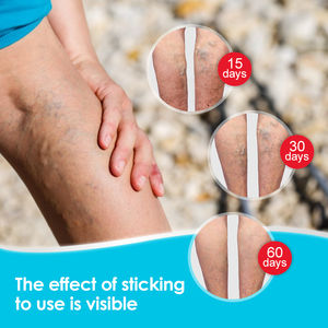 1 Stück 20g Krampfadern Creme Vaskulitis Phle bitis Oberschenkel Besen reiser Salbe Schmerz Pflaster Hautpflege Vene Swell Schmerz - Product Image 2