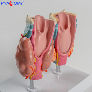 Modelo Patológico de Tiroides Humana, Hipertrófica e Hipotrófica, Sistema Endocrino, Anatomía Médica, Herramienta de Enseñanza de Tiroides y Garganta - Product Image 6