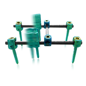 Fule 5.0mm Titanium Aanpasbaar Posterior Thoracolumbale Schroef-Stang Fixatie- en Fusiesysteem Klasse III met 5+ jaar garantie - Product Image 1