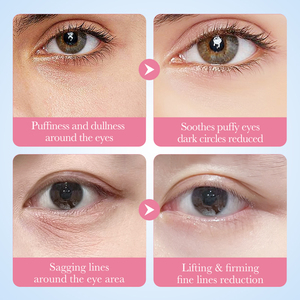 Masque Contour des Yeux Multi-Nourrissant SADOER au Collagène et Glycérine Bio, Réduit les Poches et les Cernes, Éclaircit la Peau - Product Image 5